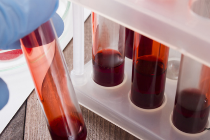 Hand hält Laborröhrchen mit Blut