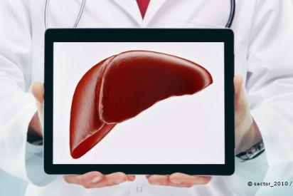 Hepatitis C